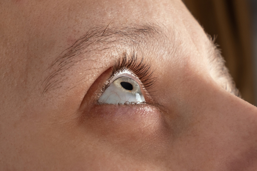 eyebrow hair transplant in thane